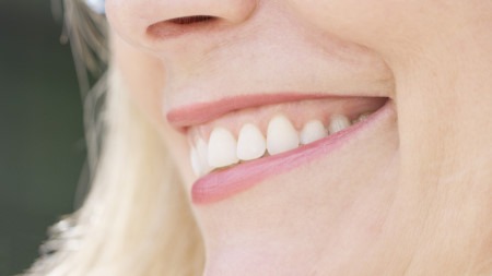 recently repaired dentures by Belleville Dentures 