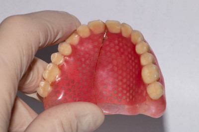 broken dentures with crack in middle