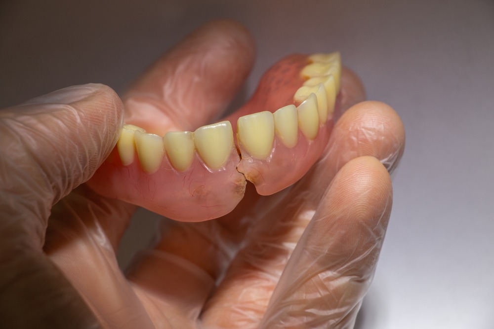 broken denture