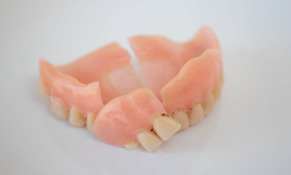 How Long Do Dentures Last? Belleville Denture Clinic