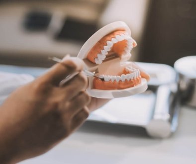 full dentures