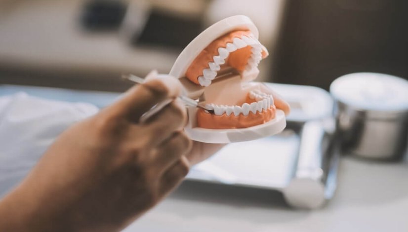 full dentures