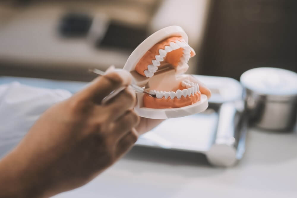 full dentures